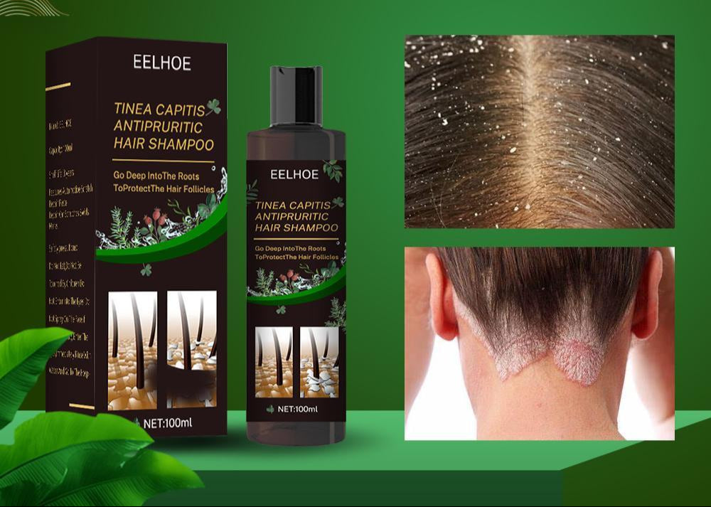 EELHOE Anti-Dandruff Shampoo - Itch Relief, Hair Loss Prevention, Oil Control & Refreshing Care