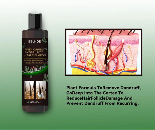 EELHOE Anti-Dandruff Shampoo - Itch Relief, Hair Loss Prevention, Oil Control & Refreshing Care
