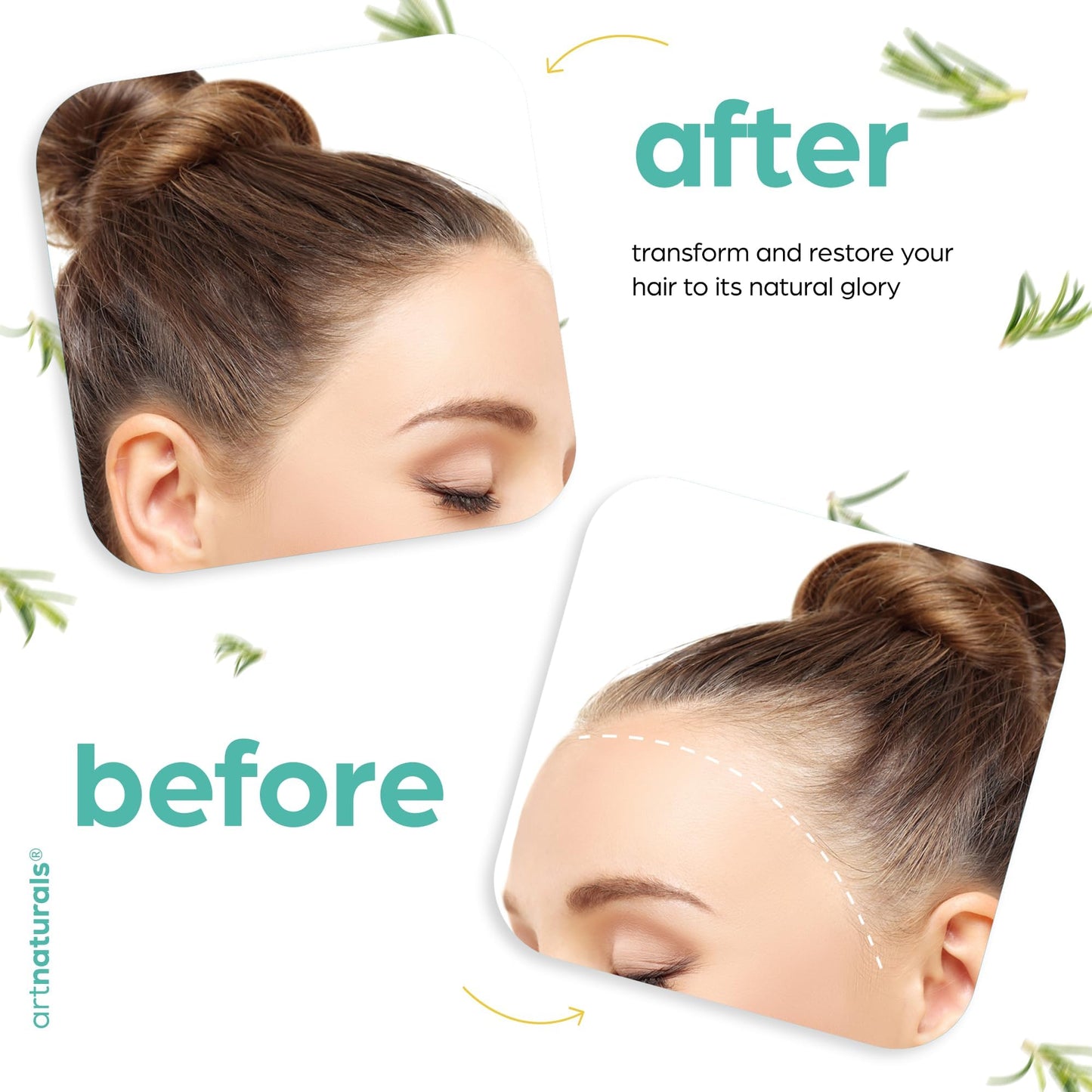 ArtNaturals Organic Rosemary & Castor Hair Growth Oil + Scalp Massager Set – Hair Styling Oils for Dry, Itchy Scalp, Thickening & Hydration - Scalp Oil Products For Damaged Hair & Split Ends – 4.0 oz