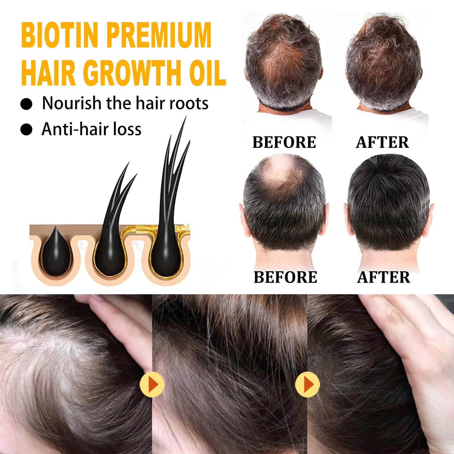 Biotin Hair Oil Deeply Moisturizing Scalp Massage Treatment Thick And Smooth Hair Care Oil