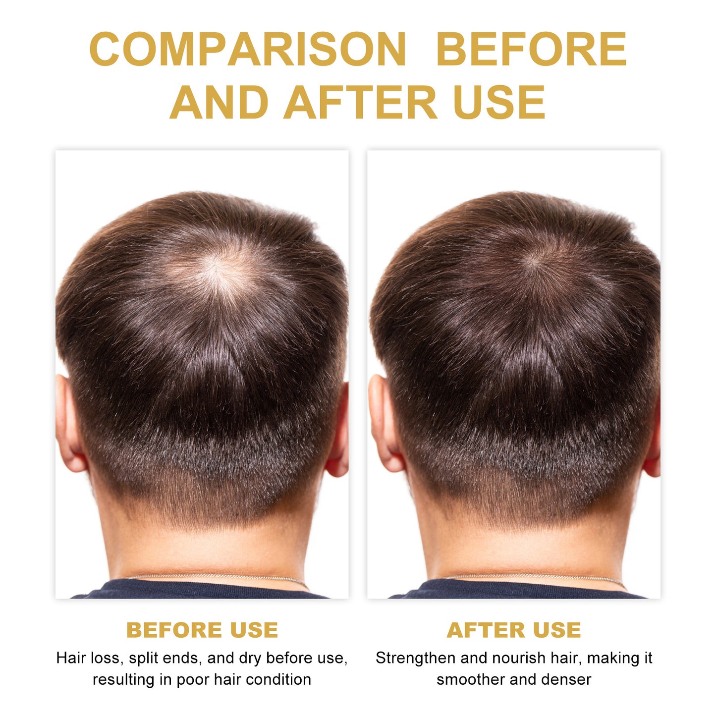 Rosemary Hair Treatment Oil Scalp Cleansing Conditioning Volumizing Smoothing Repair Dry Frizzy Hair Conditioning Hair Treatment Oil