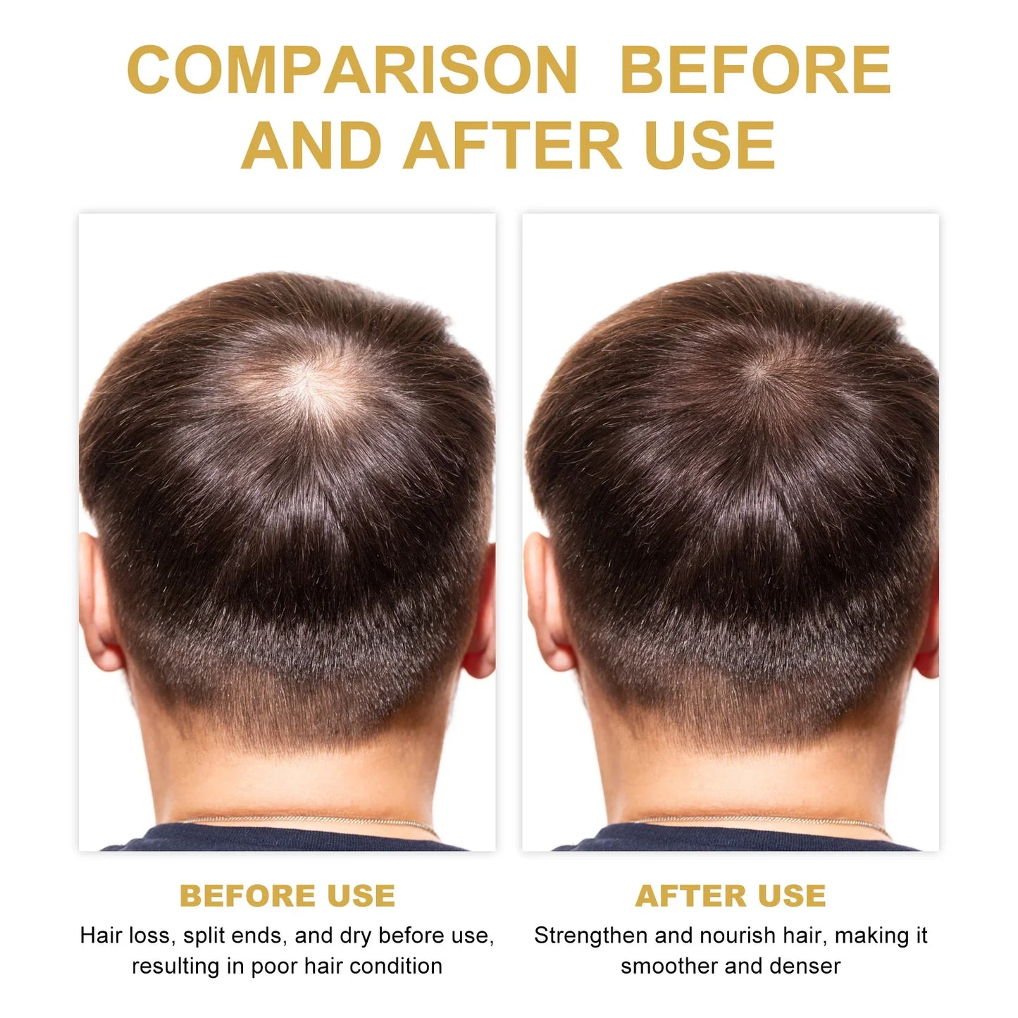 Rosemary Hair Treatment Oil Scalp Cleansing Conditioning Volumizing Smoothing Repair Dry Frizzy Hair Conditioning Hair Treatment Oil