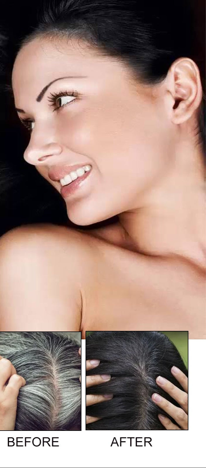 EELHOE Hair Dense Essence Hair Anti-hair Loss And Hair Fixation Nutrition