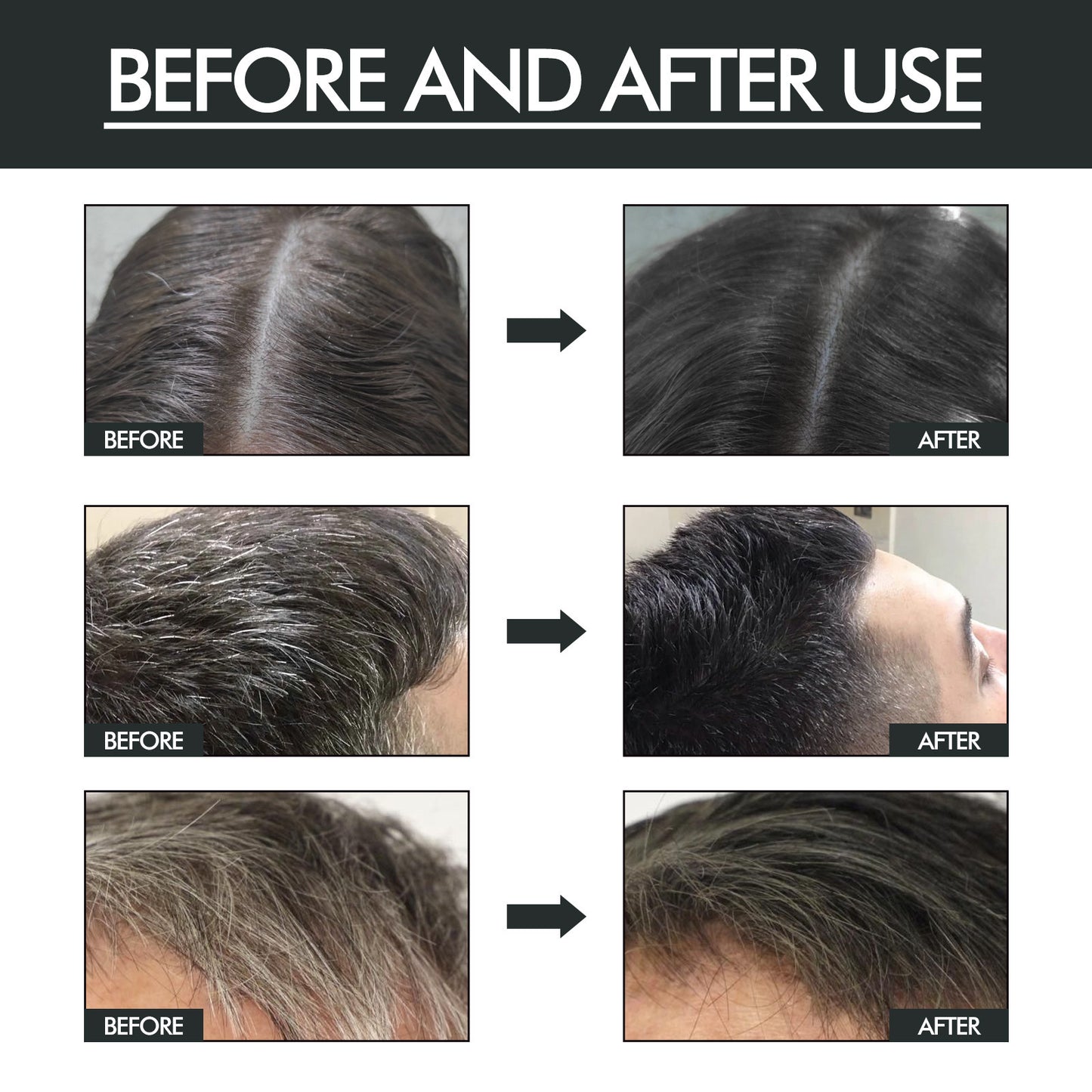 Covering Gray Hair Soft Moisturizing And Dense Care Spray