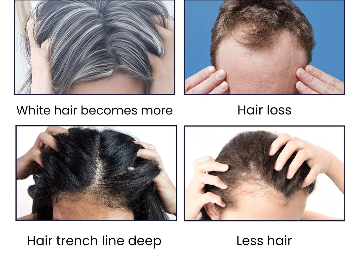 EELHOE Hair Dense Essence Hair Anti-hair Loss And Hair Fixation Nutrition