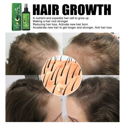 South Moon Hair Nourishing Spray Hair Strengthening Anti Hair Fall Hair Dense Hair Moisturizing Hydrating Scalp Conditioner