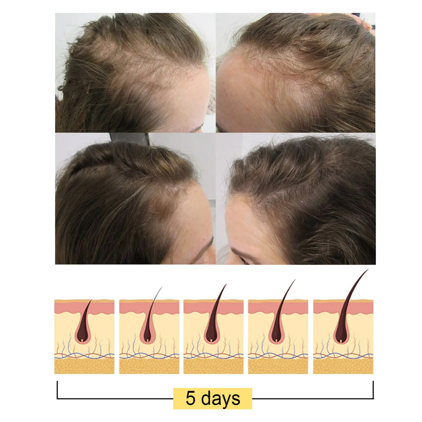 Rice Soap Shampoo Rice Promote Dense Hair Nourishing Repair Shampoo