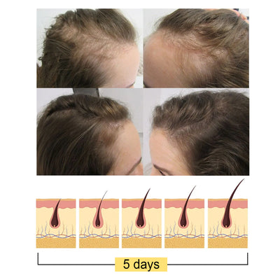 Rice Soap Shampoo Rice Promote Dense Hair Nourishing Repair Shampoo